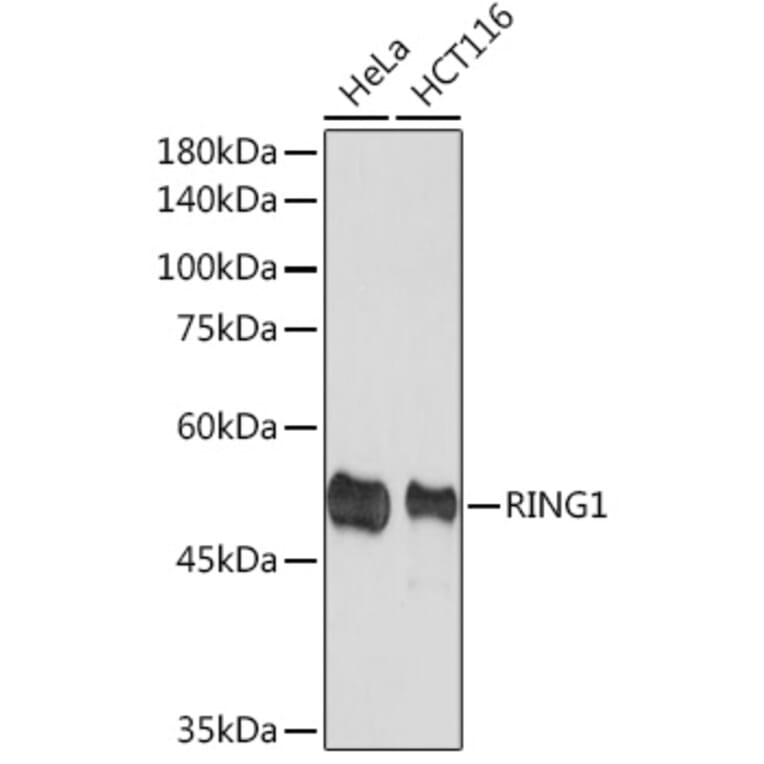 Western Blot - Anti-RING1 Antibody [ARC2278] (A305619) - Antibodies.com