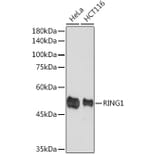 Western Blot - Anti-RING1 Antibody [ARC2278] (A305619) - Antibodies.com