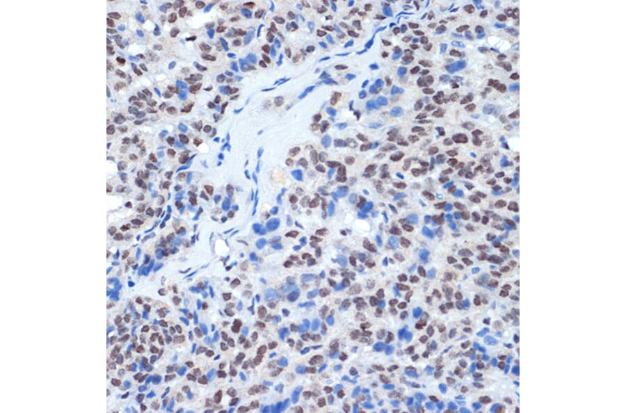 Immunohistochemistry - Anti-RING1 Antibody [ARC2278] (A305619) - Antibodies.com