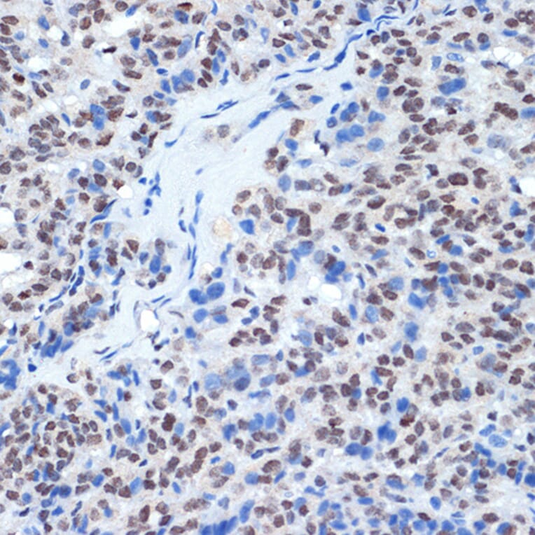 Immunohistochemistry - Anti-RING1 Antibody [ARC2278] (A305619) - Antibodies.com