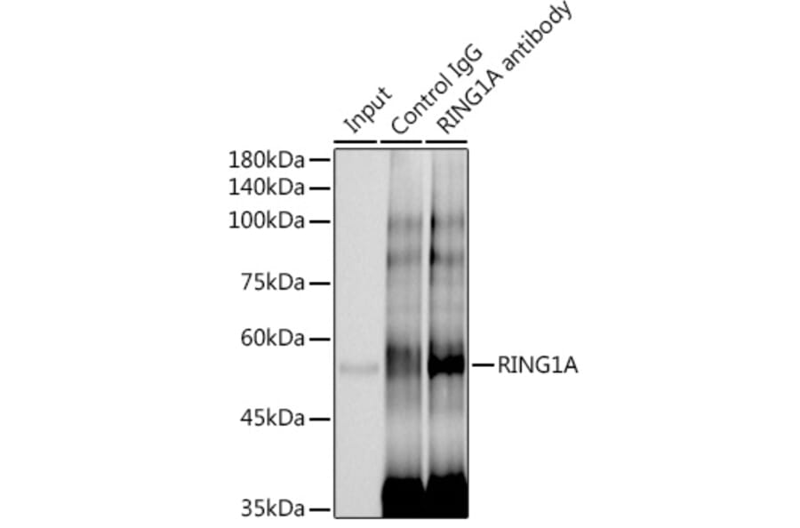 Western Blot - Anti-RING1 Antibody [ARC2278] (A305619) - Antibodies.com
