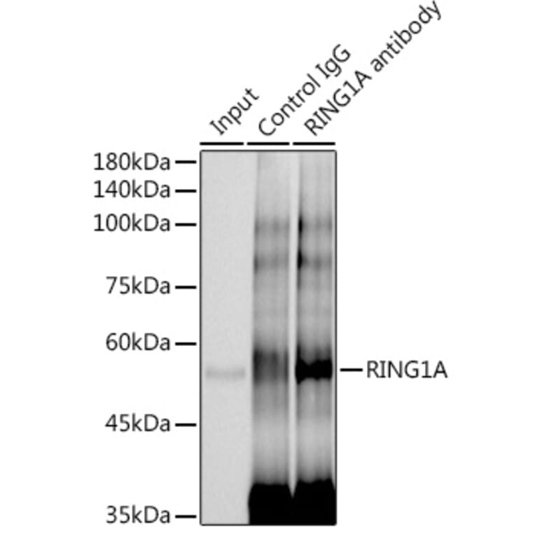 Western Blot - Anti-RING1 Antibody [ARC2278] (A305619) - Antibodies.com