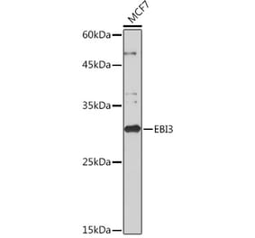 Western Blot - Anti-EBI3 Antibody [ARC2190] (A305621) - Antibodies.com