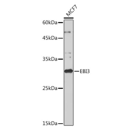 Western Blot - Anti-EBI3 Antibody [ARC2190] (A305621) - Antibodies.com