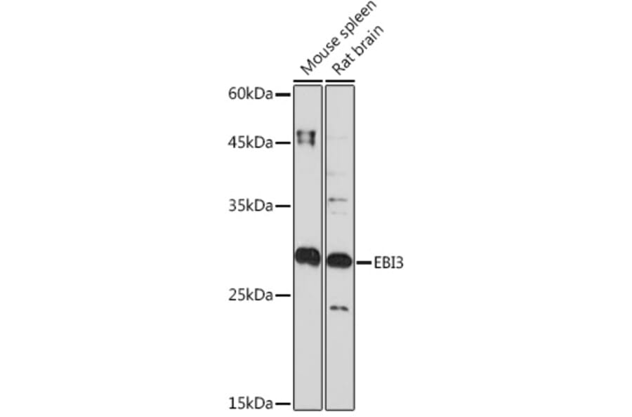 Western Blot - Anti-EBI3 Antibody [ARC2190] (A305621) - Antibodies.com