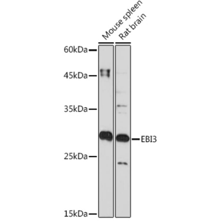 Western Blot - Anti-EBI3 Antibody [ARC2190] (A305621) - Antibodies.com