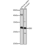 Western Blot - Anti-EBI3 Antibody [ARC2190] (A305621) - Antibodies.com