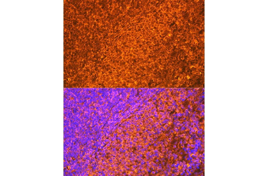 Immunofluorescence - Anti-EBI3 Antibody [ARC2190] (A305621) - Antibodies.com
