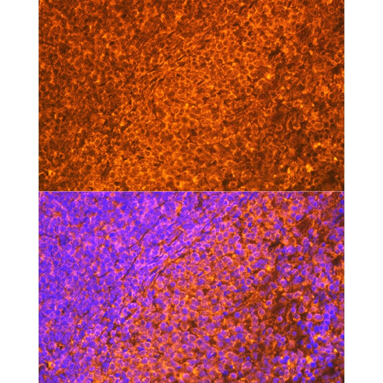 Immunofluorescence - Anti-EBI3 Antibody [ARC2190] (A305621) - Antibodies.com