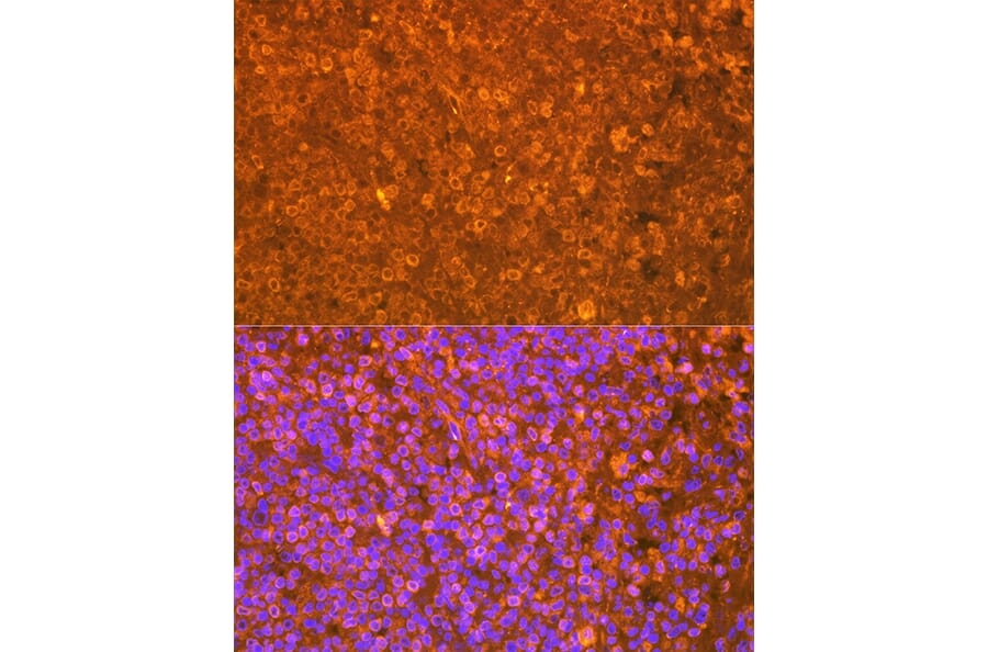 Immunofluorescence - Anti-EBI3 Antibody [ARC2190] (A305621) - Antibodies.com