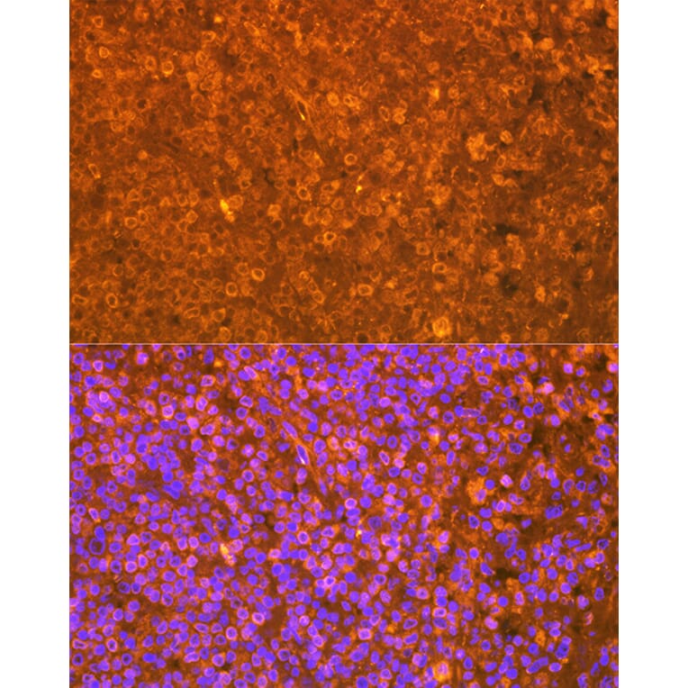 Immunofluorescence - Anti-EBI3 Antibody [ARC2190] (A305621) - Antibodies.com