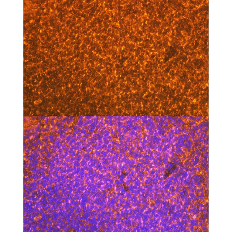 Immunofluorescence - Anti-EBI3 Antibody [ARC2190] (A305621) - Antibodies.com