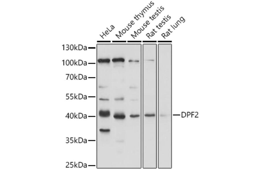 Western Blot - Anti-DPF2/REQ Antibody (A305622) - Antibodies.com