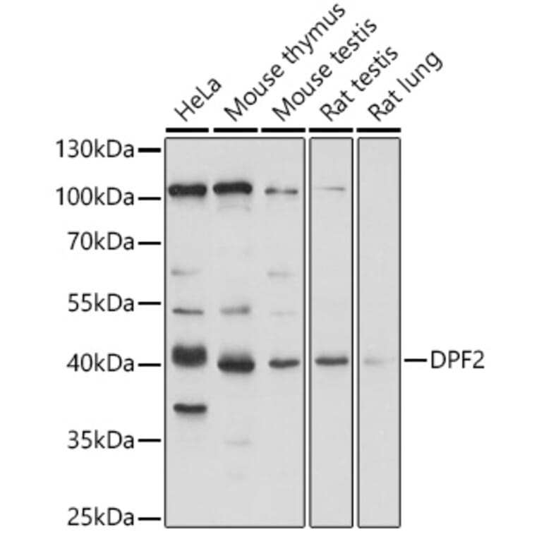 Western Blot - Anti-DPF2/REQ Antibody (A305622) - Antibodies.com
