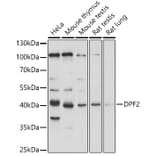 Western Blot - Anti-DPF2/REQ Antibody (A305622) - Antibodies.com
