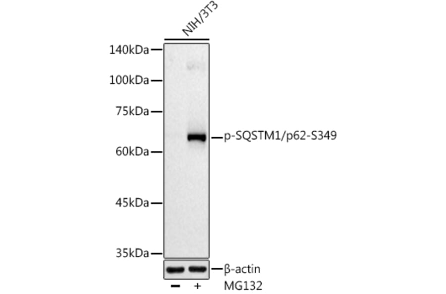Western Blot - Anti-SQSTM1/p62 (phospho Ser349) Antibody (A305624) - Antibodies.com