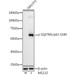 Western Blot - Anti-SQSTM1/p62 (phospho Ser349) Antibody (A305624) - Antibodies.com