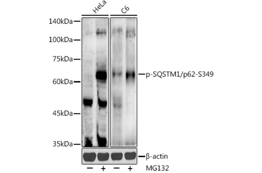 Western Blot - Anti-SQSTM1/p62 (phospho Ser349) Antibody (A305624) - Antibodies.com
