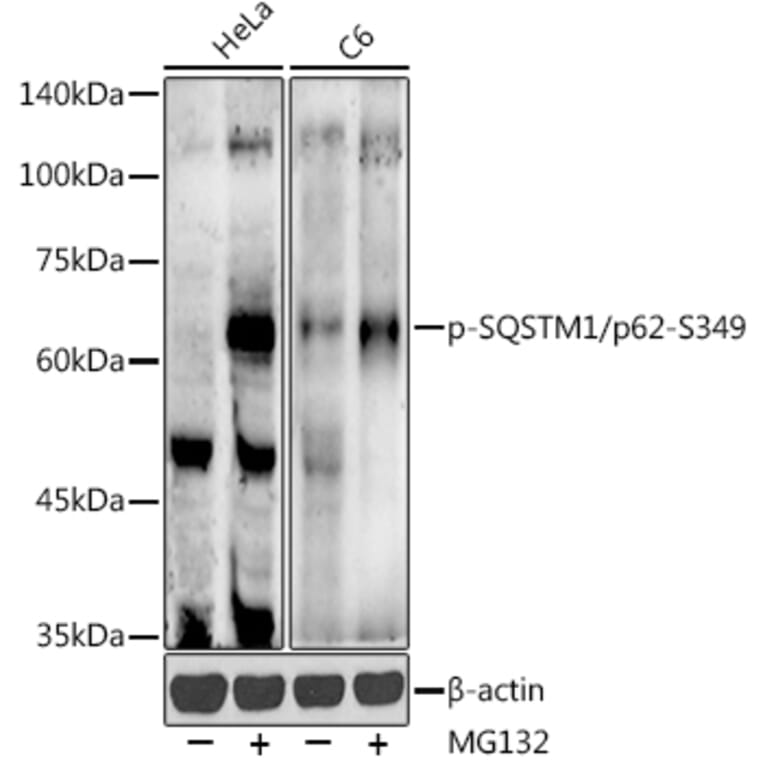 Western Blot - Anti-SQSTM1/p62 (phospho Ser349) Antibody (A305624) - Antibodies.com
