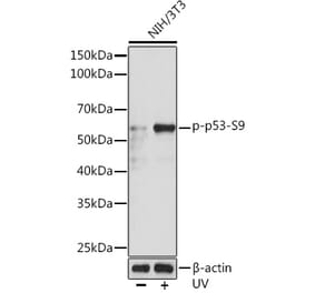 Western Blot - Anti-p53 (phospho Ser9) Antibody (A305625) - Antibodies.com