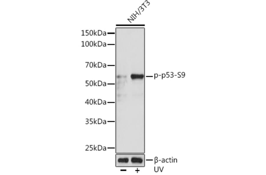 Western Blot - Anti-p53 (phospho Ser9) Antibody [ARC1529] (A305625) - Antibodies.com