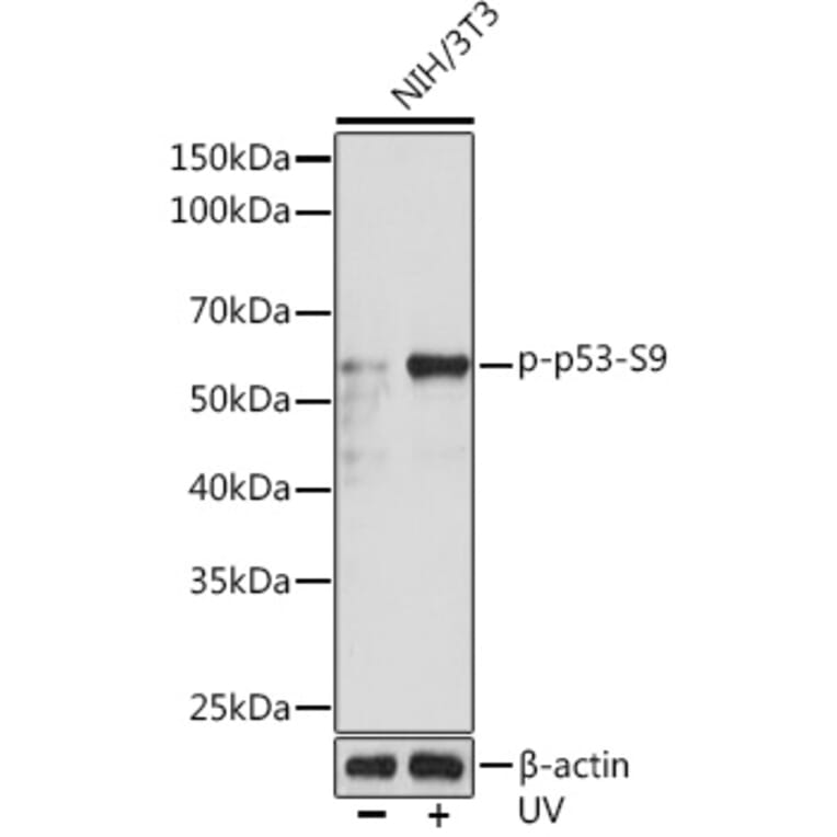 Western Blot - Anti-p53 (phospho Ser9) Antibody [ARC1529] (A305625) - Antibodies.com
