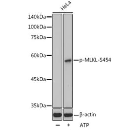 Western Blot - Anti-MLKL (phospho Ser454) Antibody (A305626) - Antibodies.com