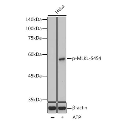 Western Blot - Anti-MLKL (phospho Ser454) Antibody (A305626) - Antibodies.com