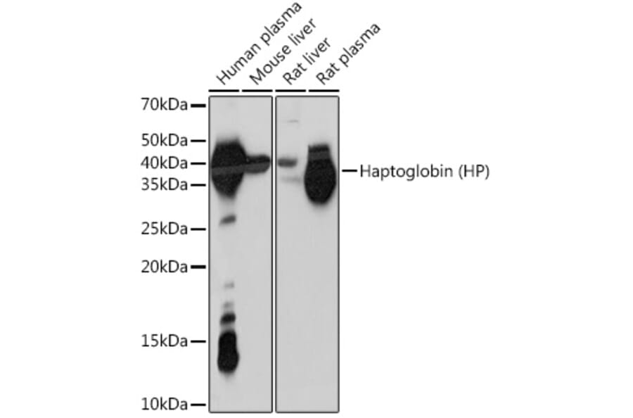 Western Blot - Anti-Haptoglobin Antibody [ARC1298] (A305627) - Antibodies.com