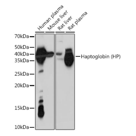 Western Blot - Anti-Haptoglobin Antibody [ARC1298] (A305627) - Antibodies.com