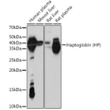Western Blot - Anti-Haptoglobin Antibody [ARC1298] (A305627) - Antibodies.com