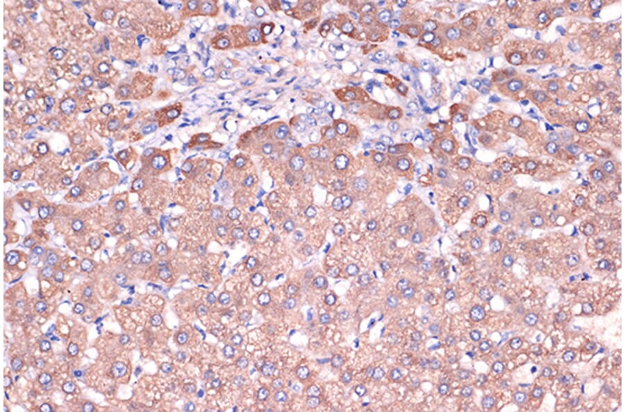 Immunohistochemistry - Anti-Haptoglobin Antibody [ARC1298] (A305627) - Antibodies.com