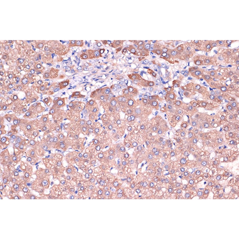 Immunohistochemistry - Anti-Haptoglobin Antibody [ARC1298] (A305627) - Antibodies.com