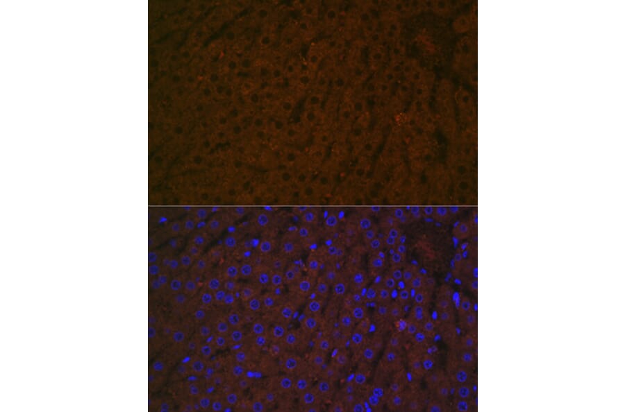 Immunofluorescence - Anti-Haptoglobin Antibody [ARC1298] (A305627) - Antibodies.com