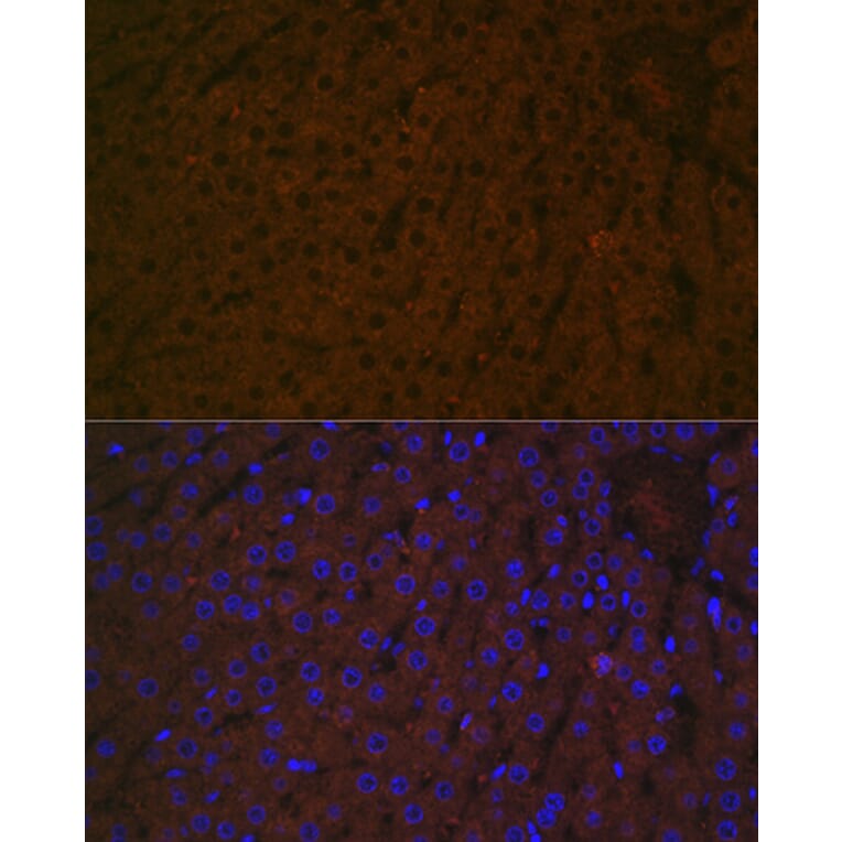 Immunofluorescence - Anti-Haptoglobin Antibody [ARC1298] (A305627) - Antibodies.com
