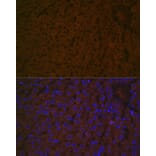 Immunofluorescence - Anti-Haptoglobin Antibody [ARC1298] (A305627) - Antibodies.com