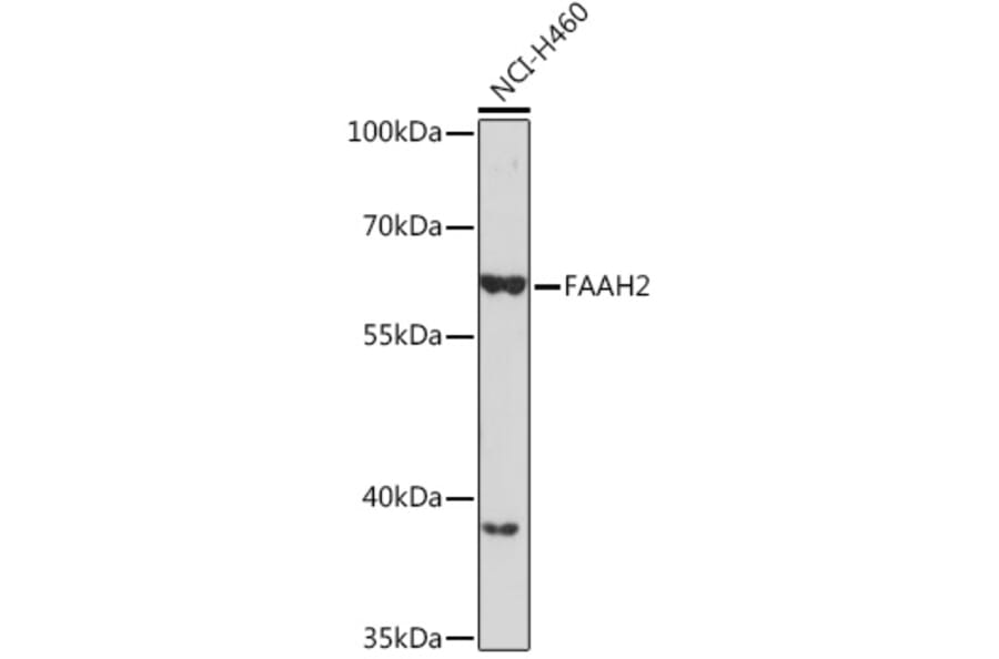 Western Blot - Anti-FAAH2 Antibody (A305628) - Antibodies.com