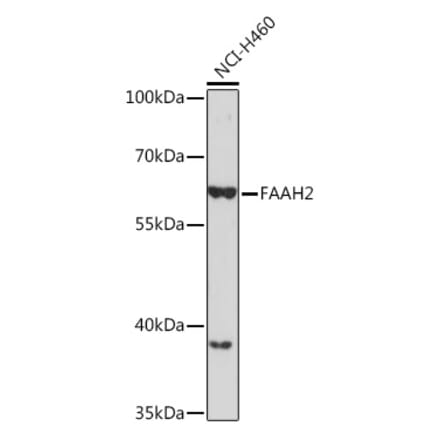 Western Blot - Anti-FAAH2 Antibody (A305628) - Antibodies.com