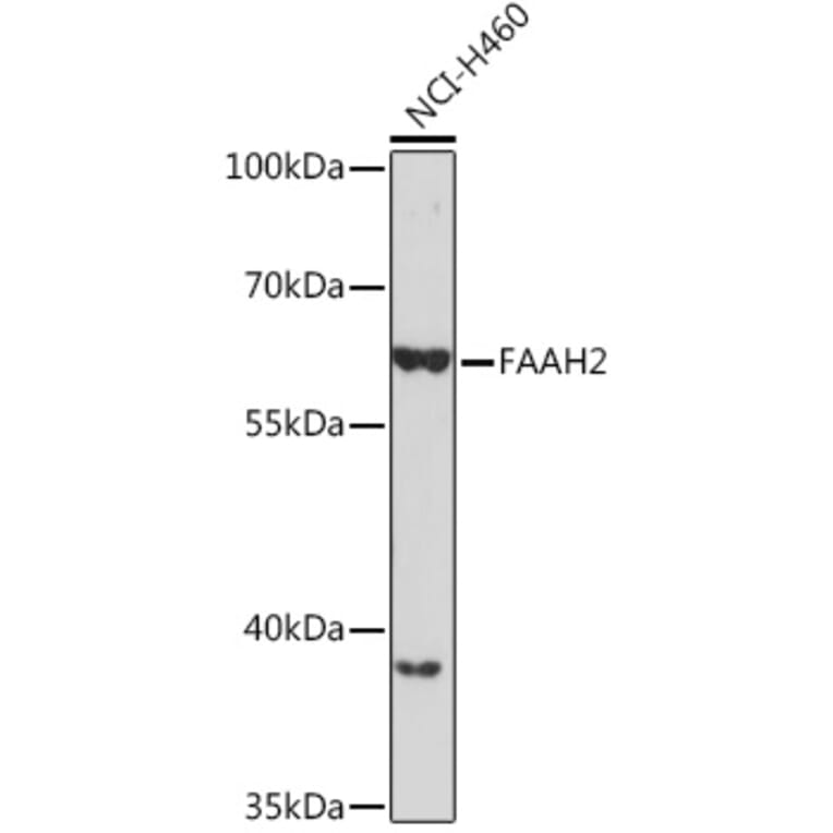 Western Blot - Anti-FAAH2 Antibody (A305628) - Antibodies.com