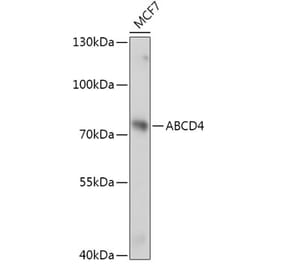 Western Blot - Anti-ABCD4 Antibody (A305629) - Antibodies.com