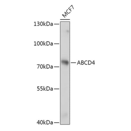 Western Blot - Anti-ABCD4 Antibody (A305629) - Antibodies.com