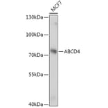 Western Blot - Anti-ABCD4 Antibody (A305629) - Antibodies.com