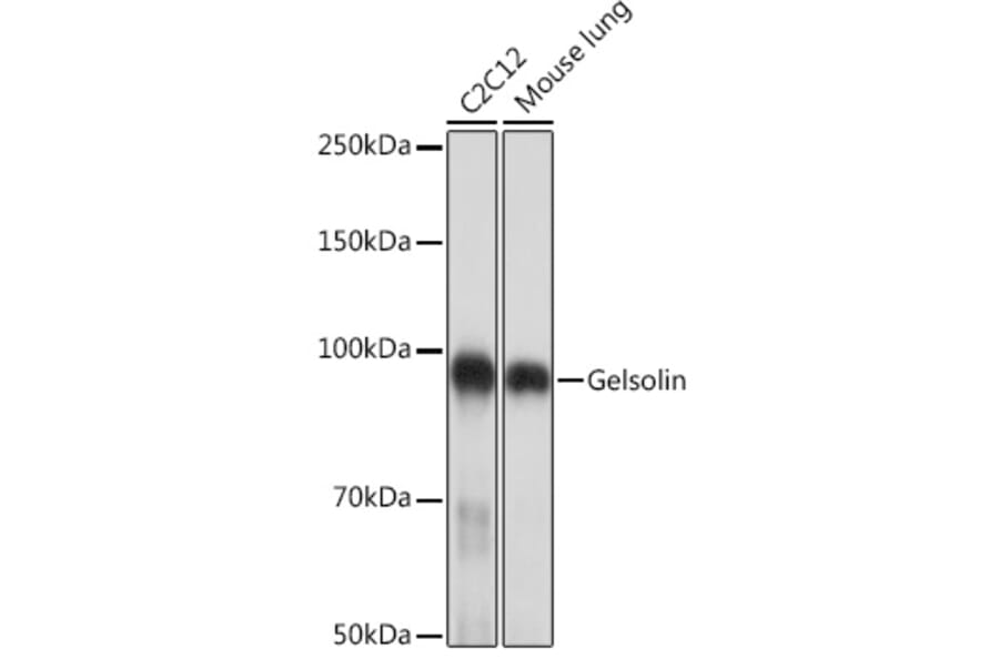 Western Blot - Anti-Gelsolin Antibody [ARC1924] (A305630) - Antibodies.com