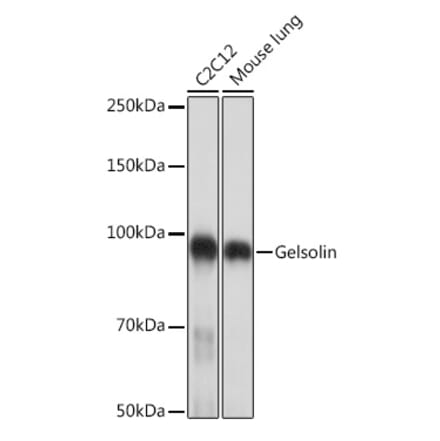 Western Blot - Anti-Gelsolin Antibody [ARC1924] (A305630) - Antibodies.com