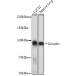 Western Blot - Anti-Gelsolin Antibody [ARC1924] (A305630) - Antibodies.com