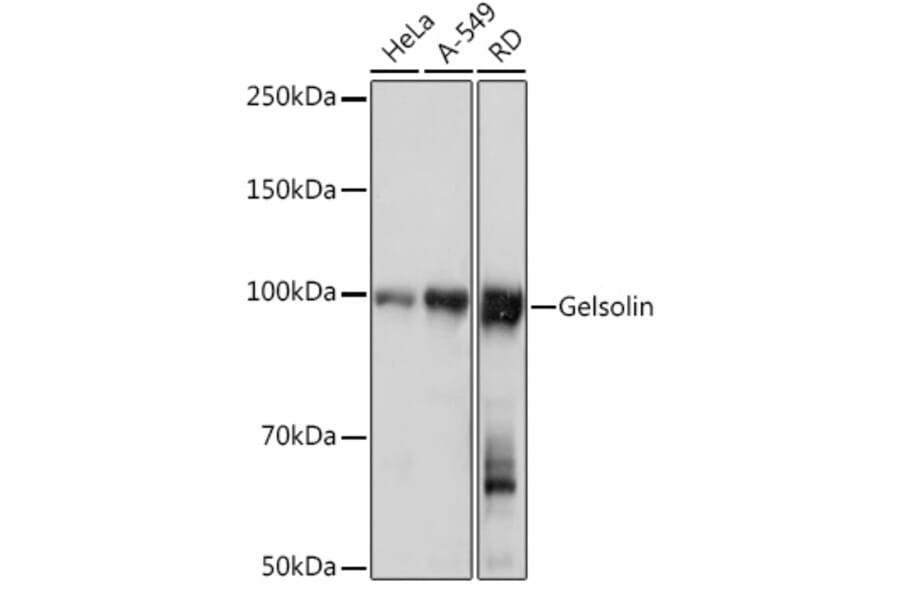 Western Blot - Anti-Gelsolin Antibody [ARC1924] (A305630) - Antibodies.com