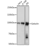 Western Blot - Anti-Gelsolin Antibody [ARC1924] (A305630) - Antibodies.com