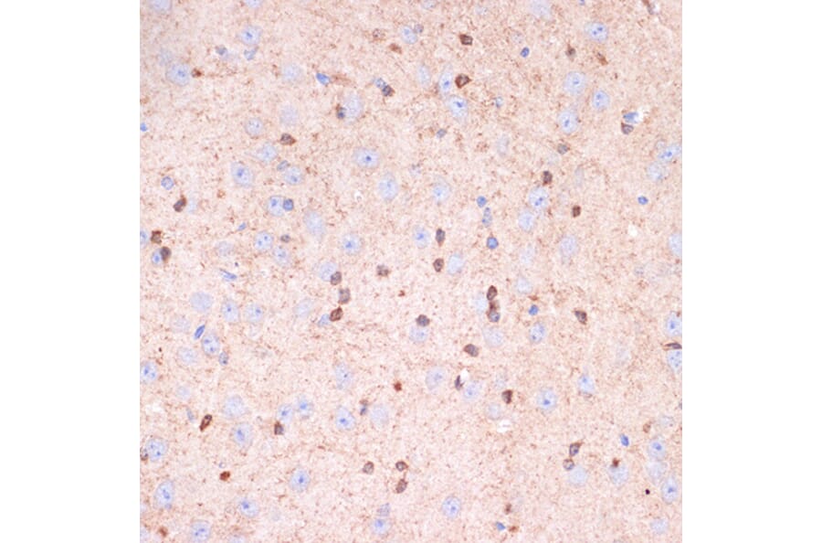 Immunohistochemistry - Anti-Gelsolin Antibody [ARC1924] (A305630) - Antibodies.com