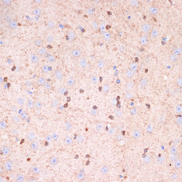Immunohistochemistry - Anti-Gelsolin Antibody [ARC1924] (A305630) - Antibodies.com