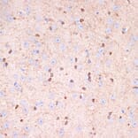 Immunohistochemistry - Anti-Gelsolin Antibody [ARC1924] (A305630) - Antibodies.com